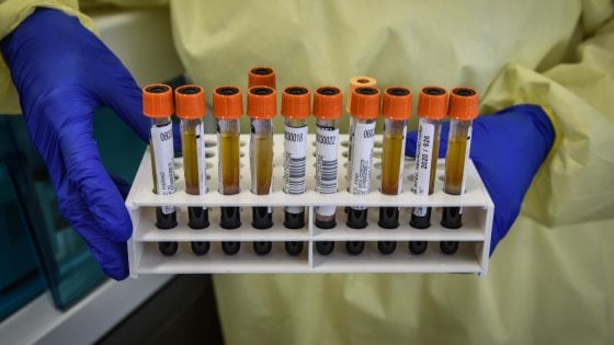 A Milano inchiesta su affidamento test&nbsp;sierologici